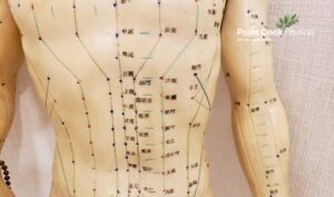 Acupuncture for Pain Relief | Point Cook Physical