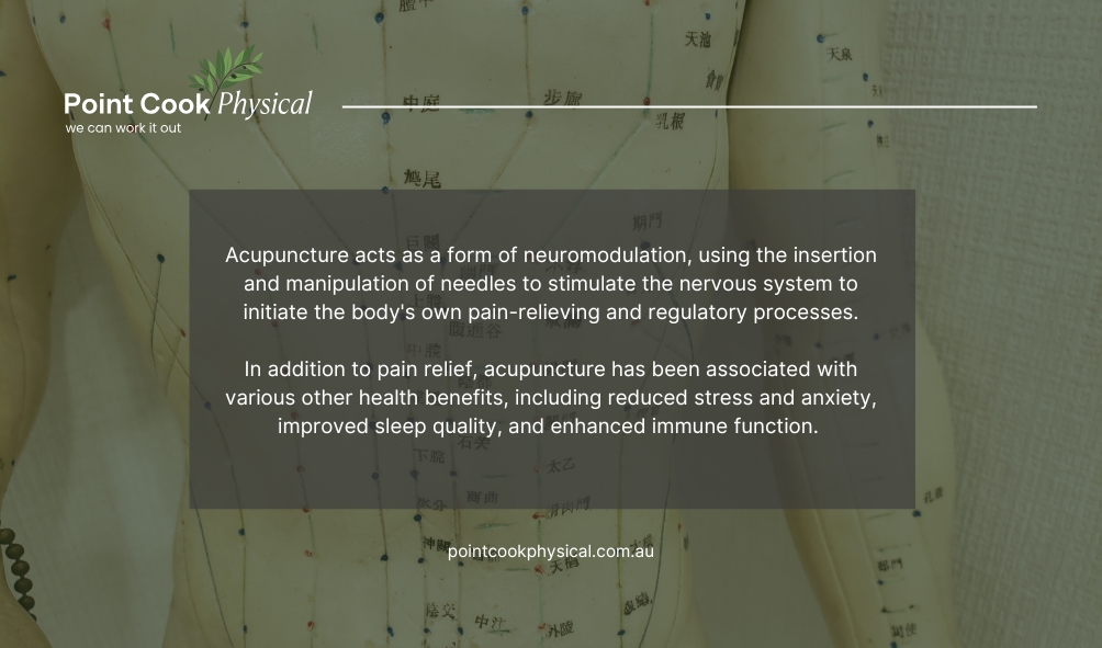Point Cook Acupuncture | Exploring Acupuncture For Pain Management