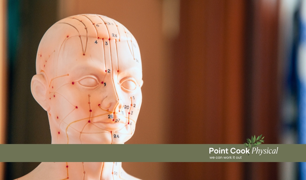 Needling away pain: exploring acupuncture for pain management 2 Point Cook Acupuncturist for Chronic Pain | Point Cook Physical