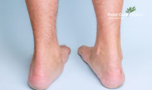 Flat Feet Podiatrist Point Cook | Point Cook Physical