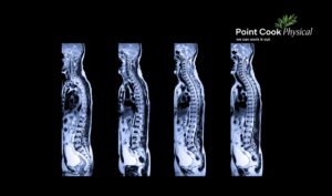 MRI vs Ultrasound | Point Cook Physical