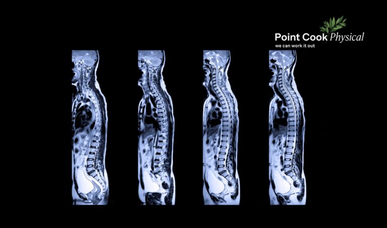 MRI vs Ultrasound | Point Cook Physical
